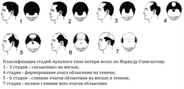 Шампунь от выпадения волос для мужчин – основные критерии выбора, рекомендации специалистов