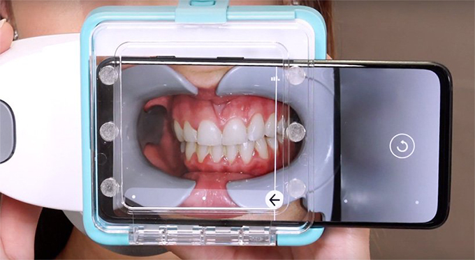 Вещь дня: устройство, которое поможет лечить зубы, когда стоматологи на карантине