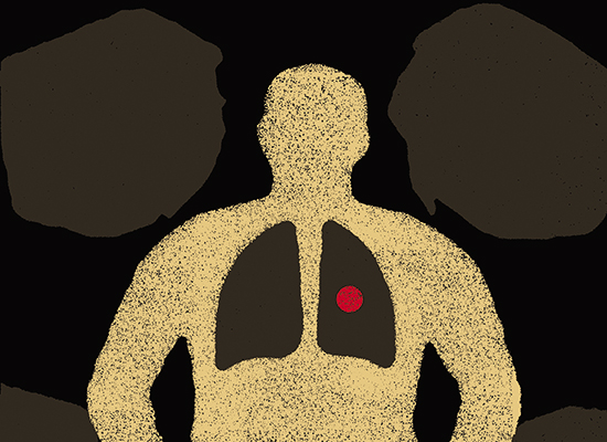 
        
            Всемирный день борьбы с туберкулезом: что тебе нужно знать о болезни
        
        
            
                
            
        
    